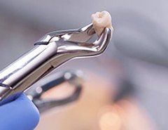 dentist performing a tooth extraction in Newark holding dental forceps