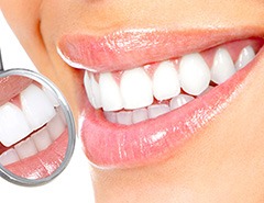 Closeup of woman’s smile being reflected in dental mirror with white background